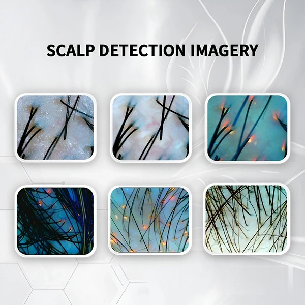 Scalp Detection
