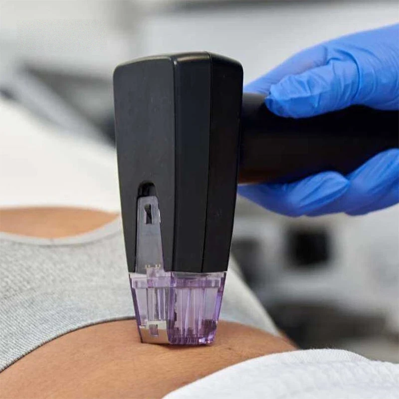 fractional RF microneedling microneedling Applications