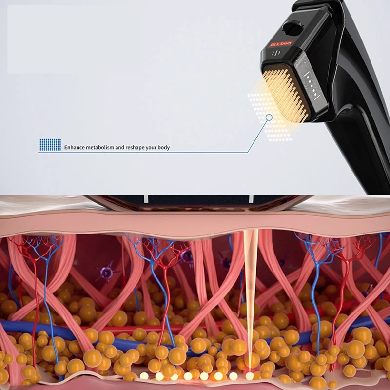 4D HIFU Handpiece