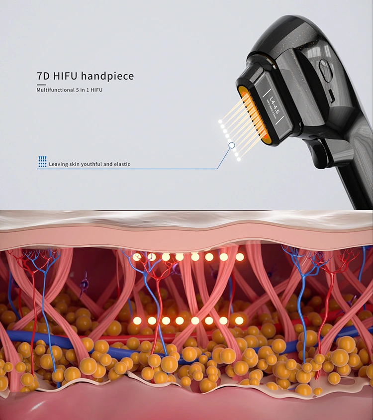 7D HIFU Handpiece
