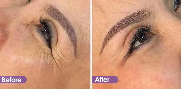 Anti-wrinkle and firming around eyes