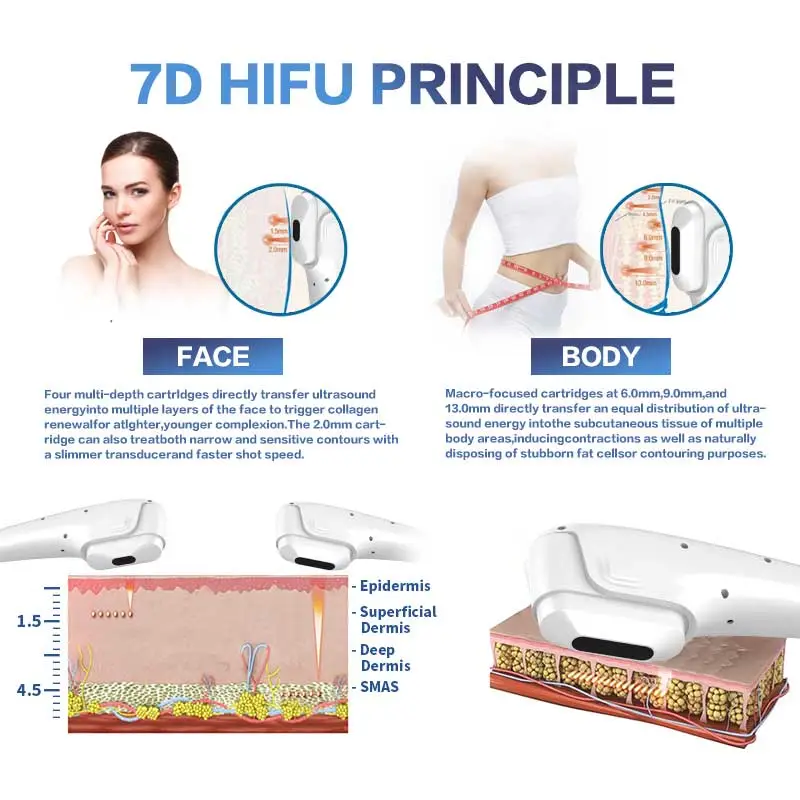 How 7D HIFU work?