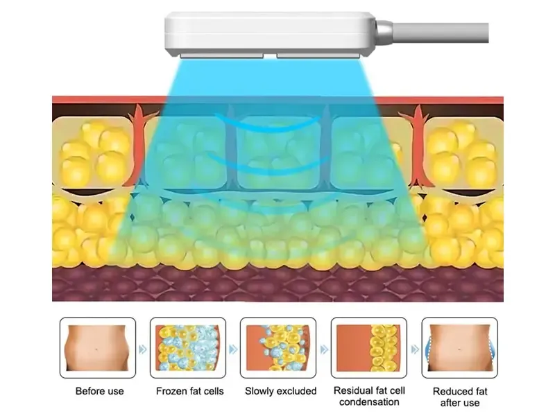 How does Cooling Pads work?