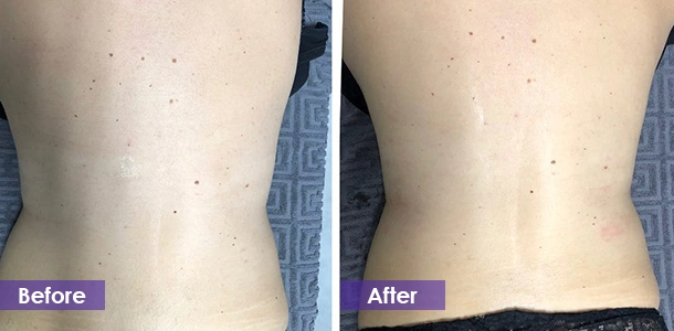 Waist fat loss before and after