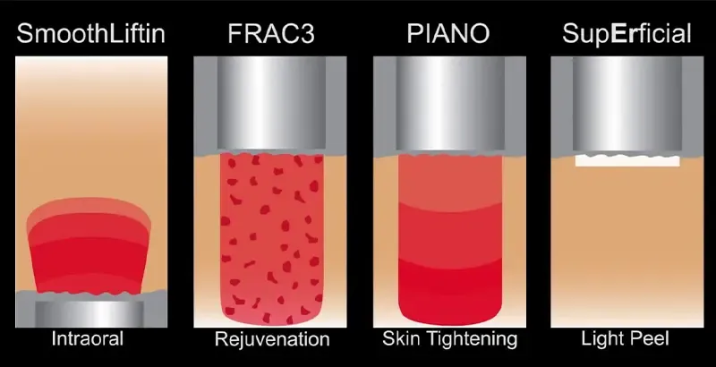 How dual-wavelength laser 4D laser work？